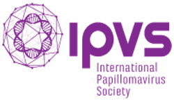 IPVS
